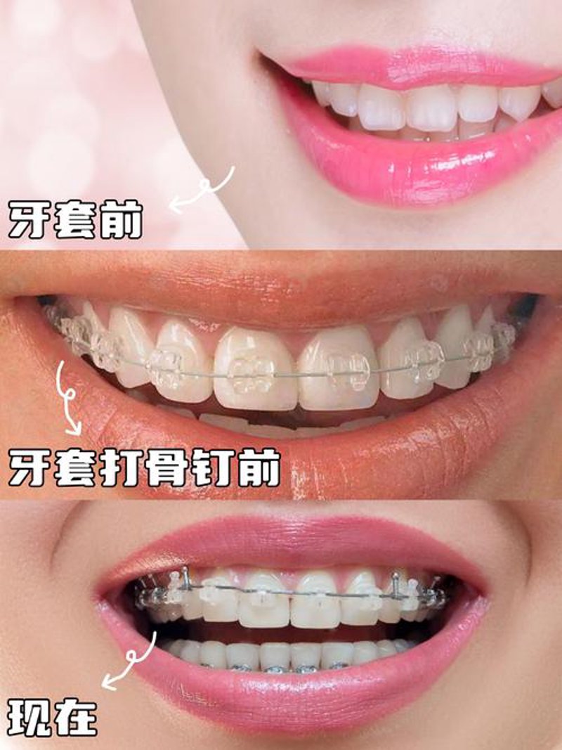 儿童齿科