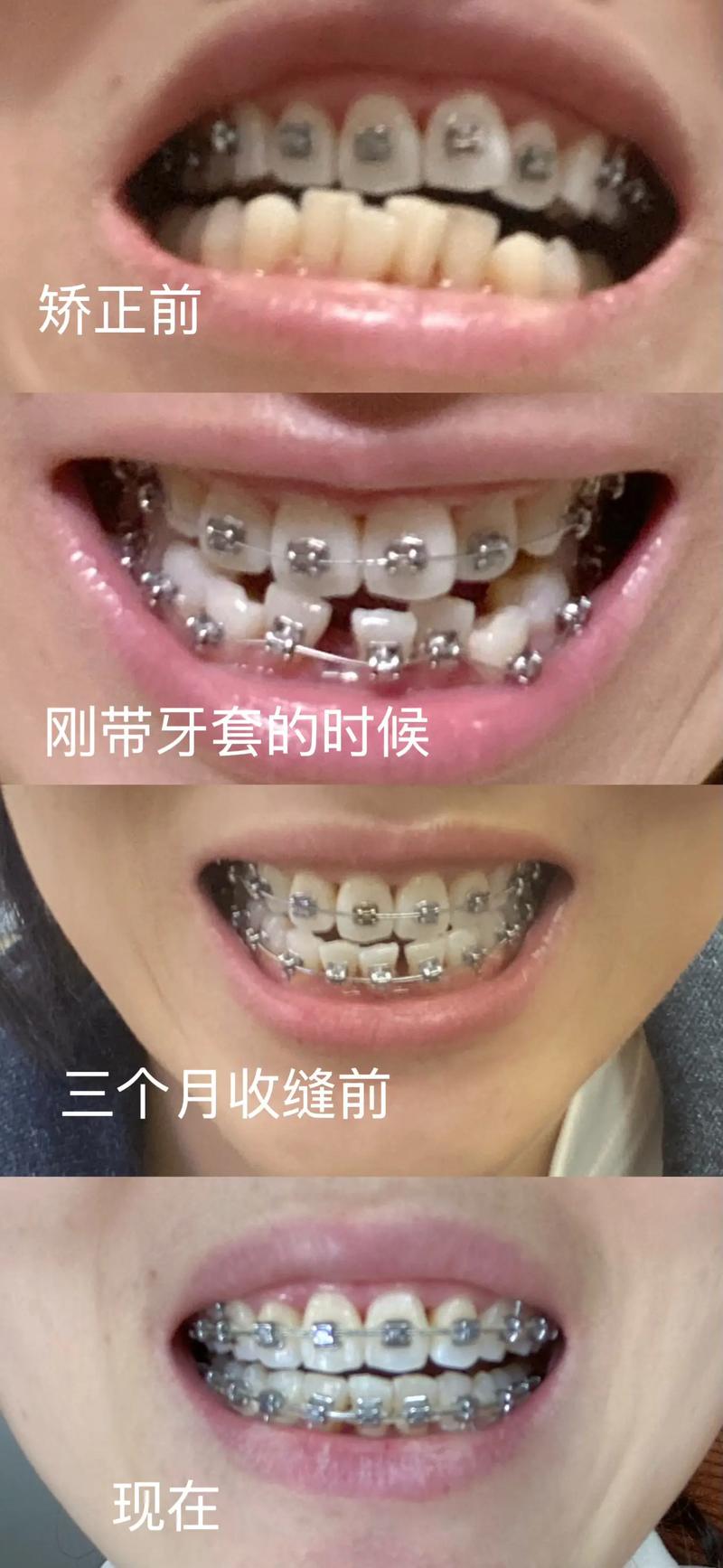 周娟口腔：守护笑容的工匠之道