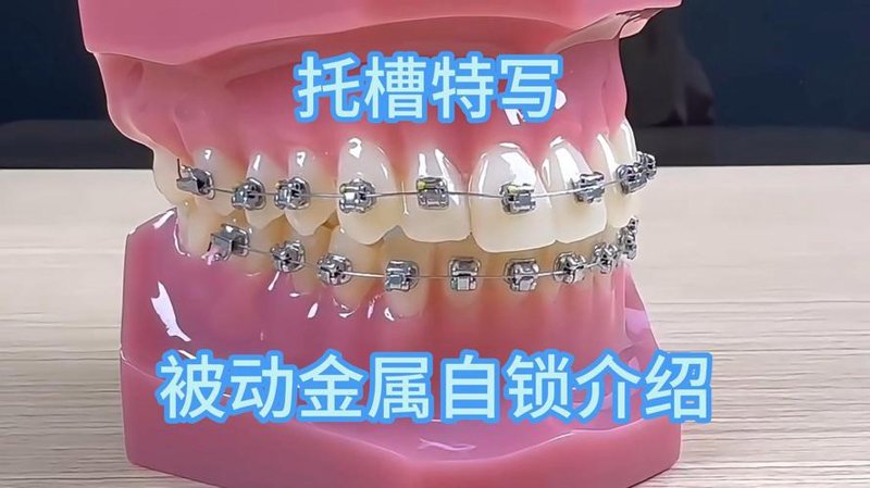 口腔修复